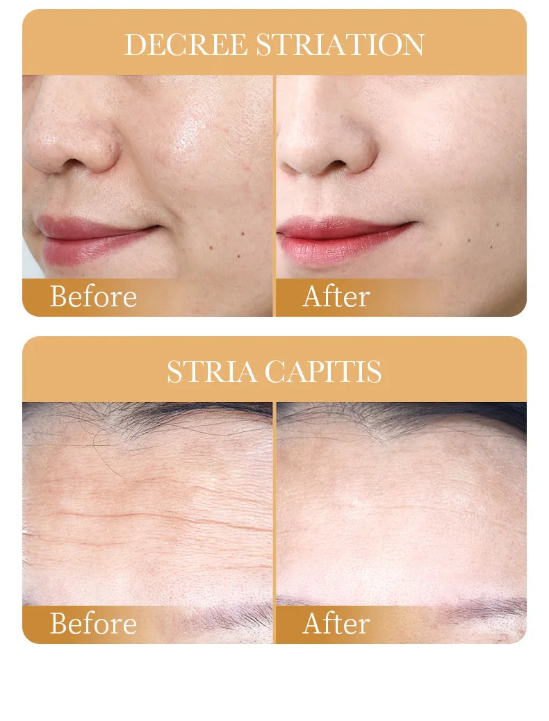 10pcs Anti-wrinkle Collagen Face Mask
